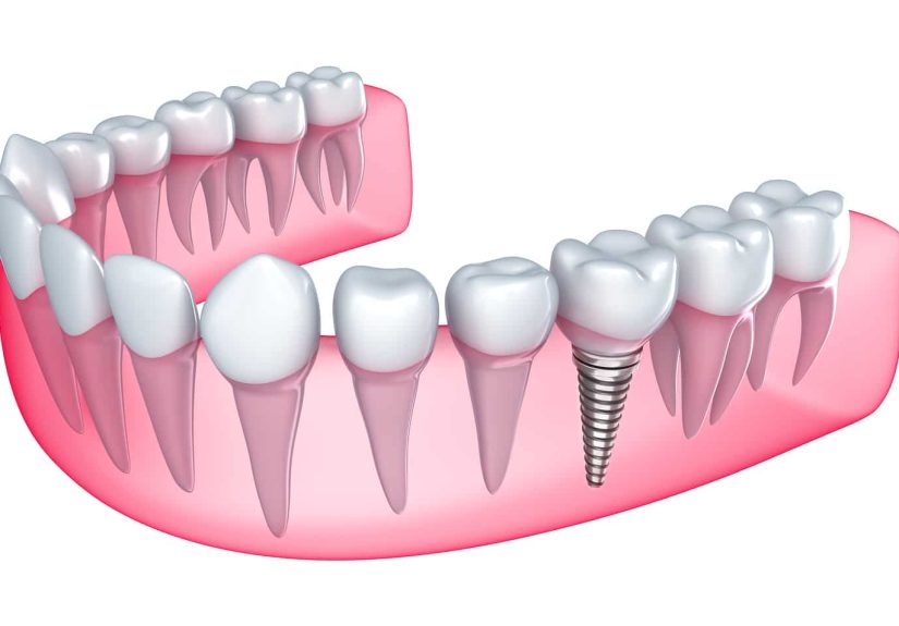 Harnessing Nature's Wisdom: Integrating Biophilic Design in Dentistry